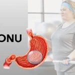 Mide Balonu Nedir?