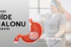 Mide Balonu Nedir?