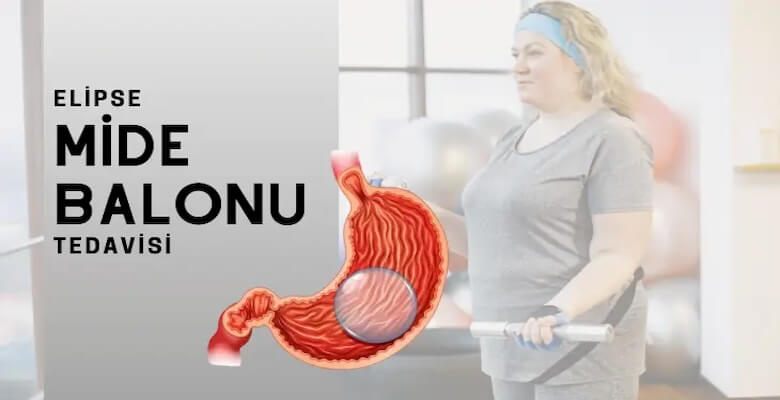 Mide Balonu Nedir?