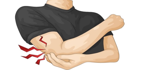 Kubital Tünel Ameliyatı: Dirsekte Sinir Sıkışmasının Kesin Çözümü