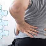 Bel Fıtığı Ameliyatı Sonrası Nüks: Neden Olur, Nelere Dikkat Edilmeli?