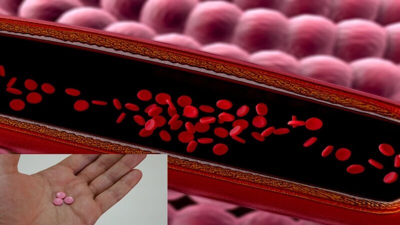 Kan Sulandırıcı Kullanımı Artıyor: Ameliyata Engel mi, Gerçek Risk Ne?