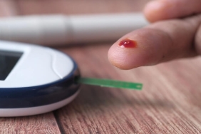 Şeker Hastalığı Olanlar Ameliyat Olabilir mi? Diyabette Cerrahi Kararının Altın Kuralları